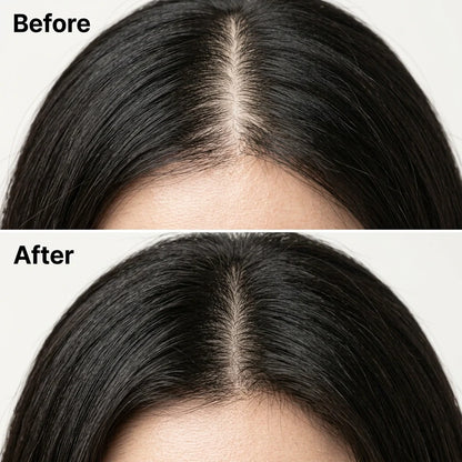 The Korean Scalp Revival Bar